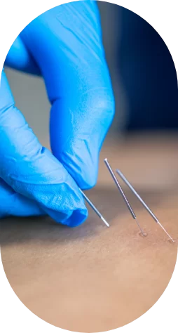 MARCAÇÃO PRÉ-CIRÚRGICA